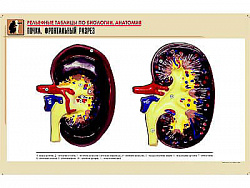 Рельефная таблица "Почка. Фронтальный разрез" (формат А1, матовое ламинир.)