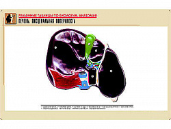 Рельефная таблица "Печень. Висцеральная поверхность" (формат А1, матовое ламинир.)